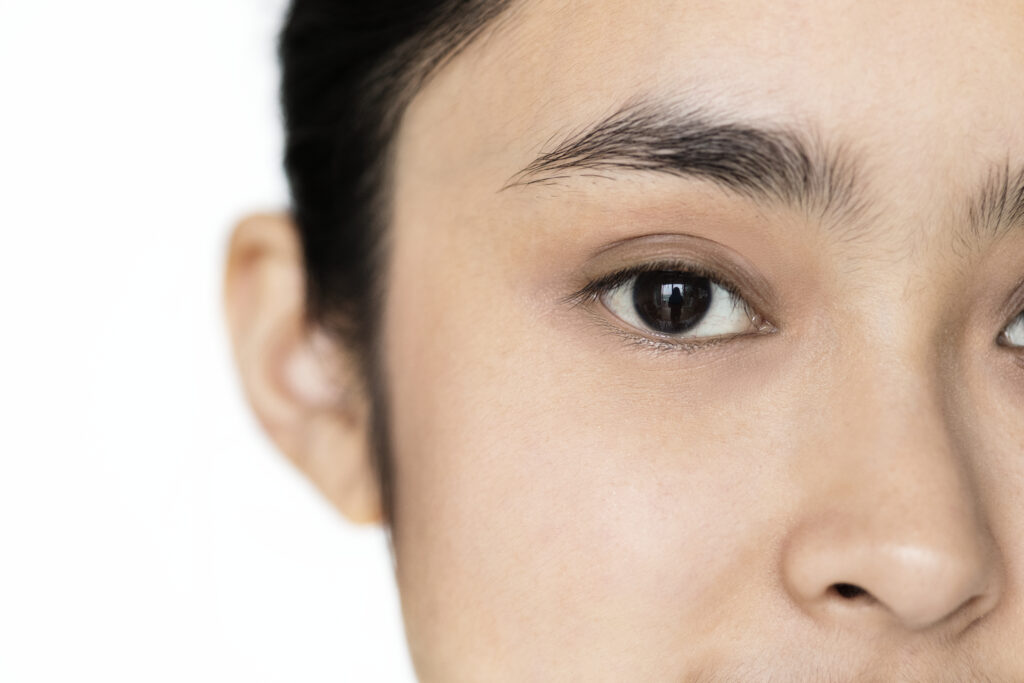 blefaroplastia asiática