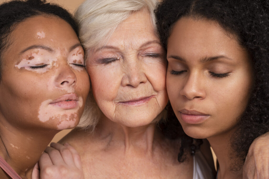 blefaroplastia em diferentes idades