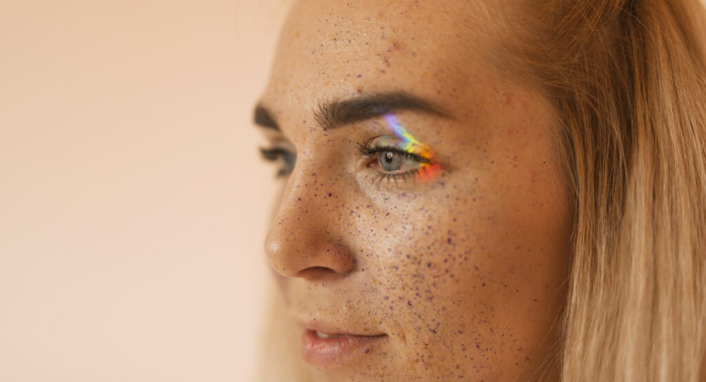 Laser de CO2 após blefaroplastia na região dos olhos